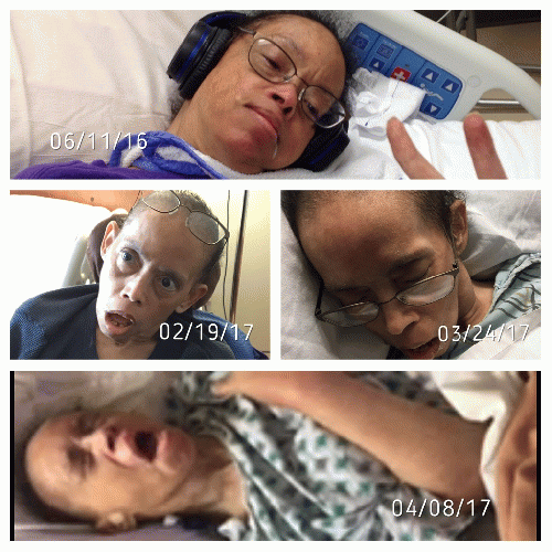(Top) Anastasia before being in the hospital. (Middle Left) Anastatia after being in Inova Fairfax Hospital and two days after Inova designated guardians placed her in Dulles Health & Rehab Center.  (Middle Right) Anastasia in Inova Fair Oaks Hospital a w, From ImagesAttr