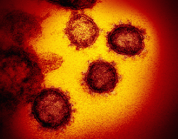 Novel Coronavirus SARS-CoV-2, From FlickrPhotos