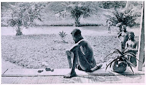 Father stares at the hand and foot of his five year-old daughter, which were severed as a punishment for having harvested too little caoutchouc/rubber.