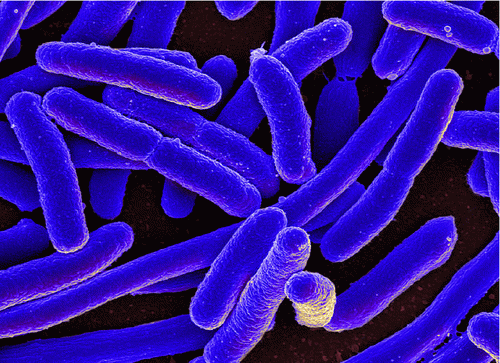 Figure 2. E. Coli infectious disease, From Uploaded